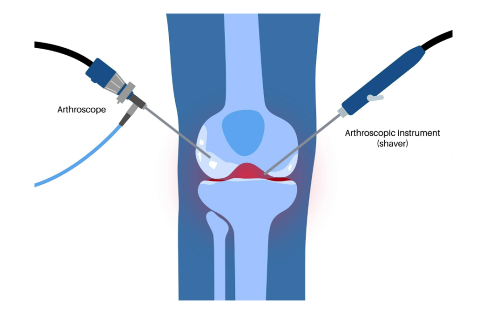 Erdemli’den Dünyaya Bir Başarı Köprüsü